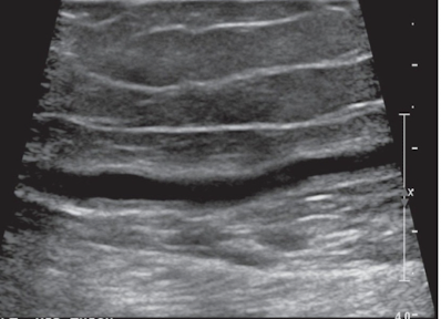 <p>smooth and uniform</p>