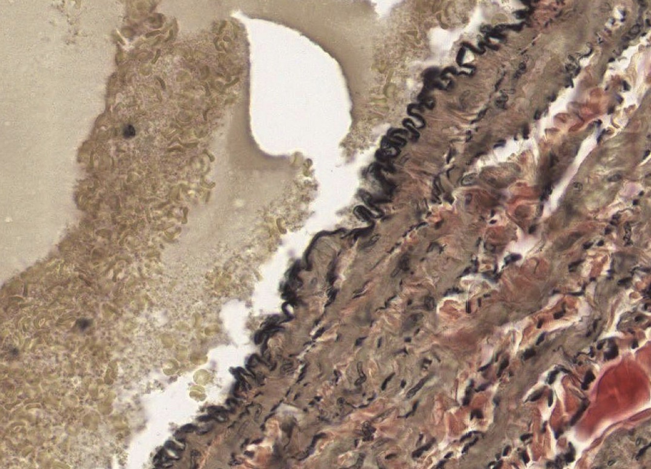 <p>Identify the Vessel and the Layer pictured</p>