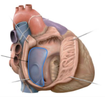 <p>What is this? where is it found? </p>