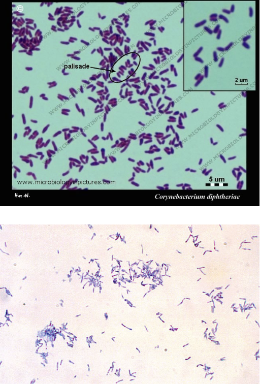 <p>which species of corynebacterium is associated with the following:</p><ul><li><p>Found only in humans</p></li><li><p>Identifying characteristics:</p><ul><li><p>Gram Stain:</p><ul><li><p>Gram Positive Rod</p></li><li><p>Non-spore forming</p></li><li><p>Pleomorphic: can be tapered, curved, or club-shaped (“koryne” is Greek for “club”)</p></li><li><p>“Chinese letters” or “picket fences” or palisades</p></li></ul></li></ul></li></ul><p></p>