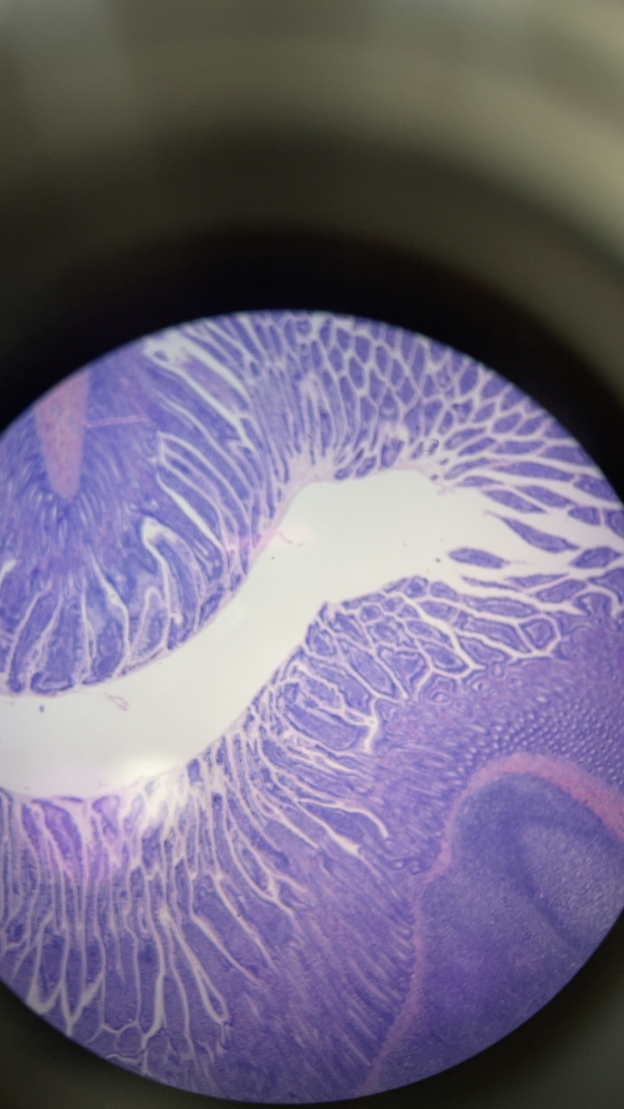 <p>identify lymphatic organ</p>