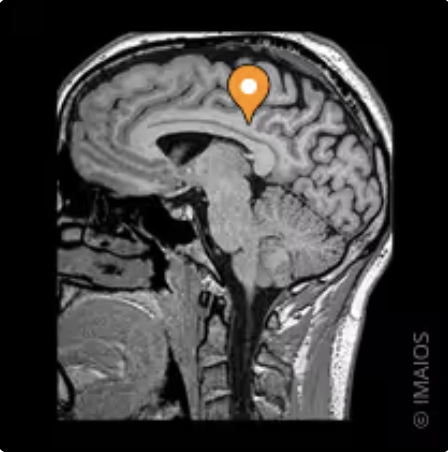 <p>Name the gyrus, modality, and the plane</p>