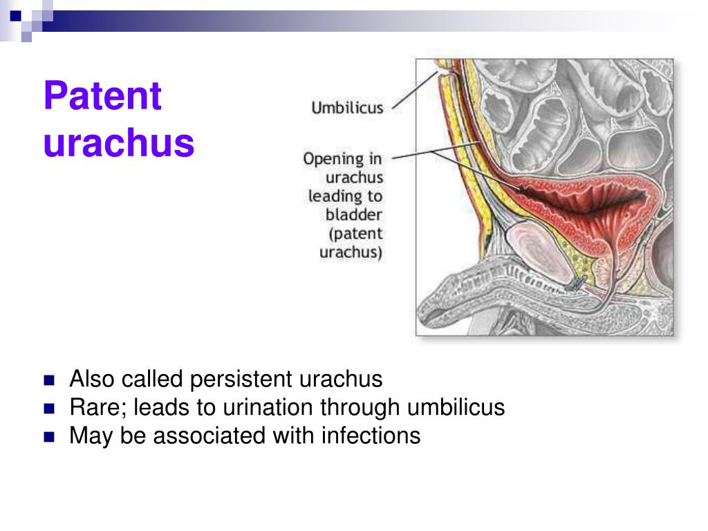 <p>urachus</p>