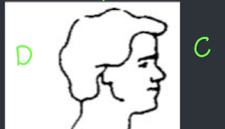 <p>What anatomical direction describes C? ***This is referring to the brain!</p>