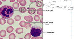 <p>What type of connective tissue is this?</p>