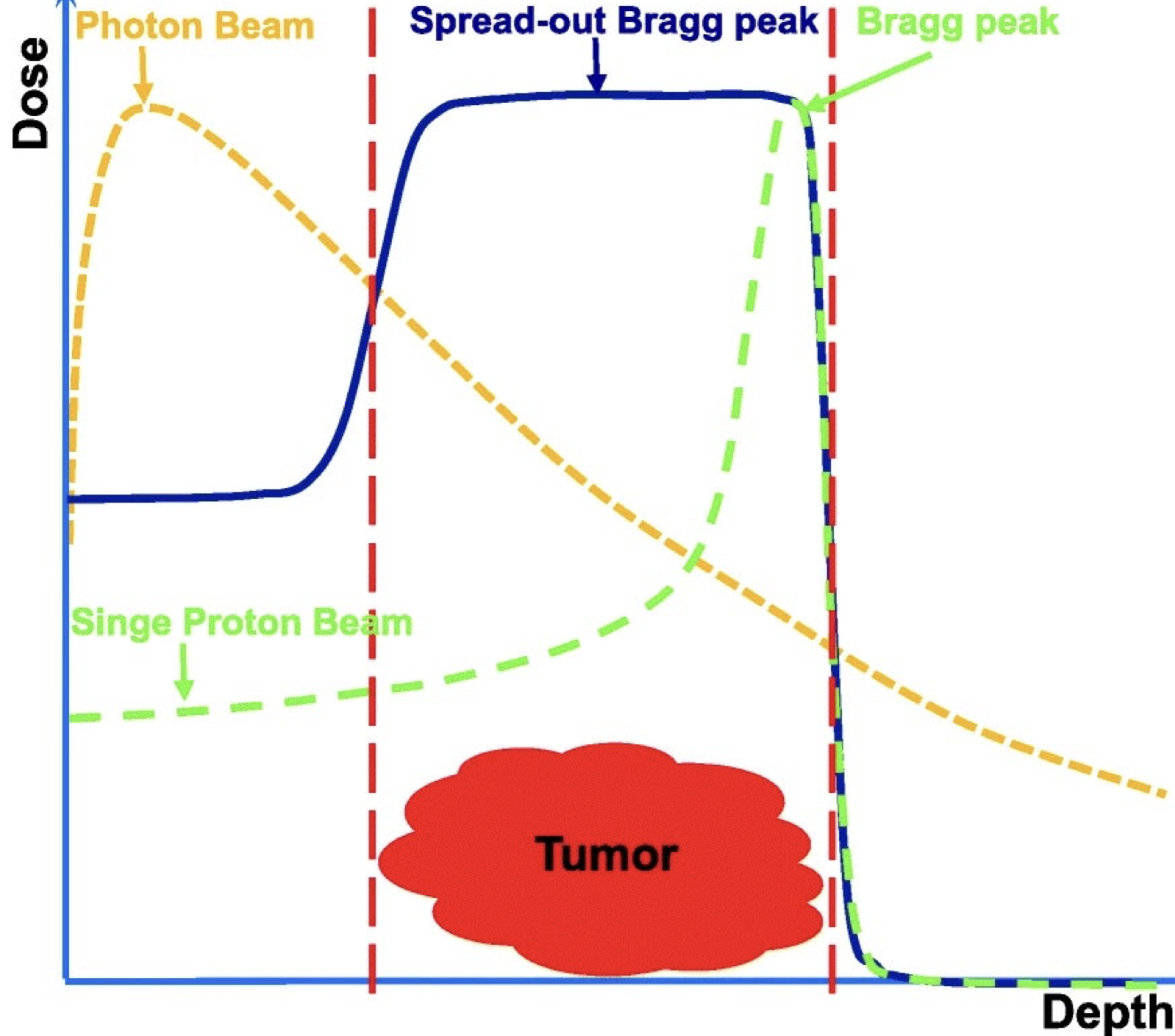 <p>Bragg peak of monoenergetic proton targets narrow depth ranges but to treat entire tumour, bragg peak is laterally spread</p><p>Incident photon beam energy is modulated, giving multiple peaks that are super-imposed into a wide, flat plateau, increasing size of treatment field</p><p>Gives flexibility in distrubuting dose </p><p>Penumbra depends on system design and setup parameters, is it possible to shield parts of</p><p class="p1">the beams to remove low-dose 'tails'</p>