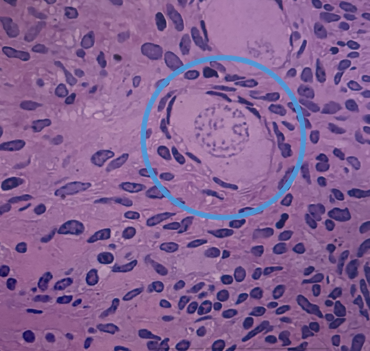 <p>single layer of squamous cells surrounding oocyte </p>