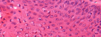 <p>soort epitheel</p>