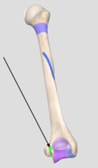 <p>between the medial epicondyle and trochlea</p>