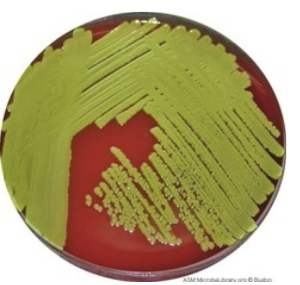 <p><strong>Other name</strong>: M. luteus</p><p><strong>Gram stain</strong>: Gram Positive: clusters, single, tetrads</p><p><strong>Catalase:</strong> positive</p><p><strong>Coagulase:</strong> negative</p><p><strong>Test</strong>: modified oxidase is positive</p>