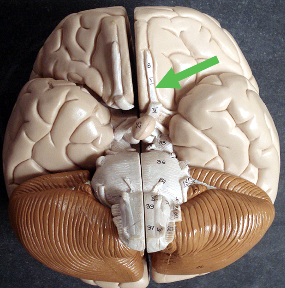 <p>Identify the area of the brain at the tip of the pointer.</p>