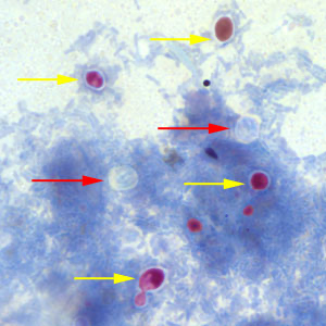 term image