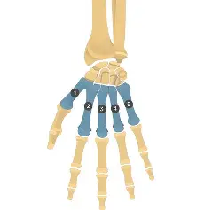 term image
