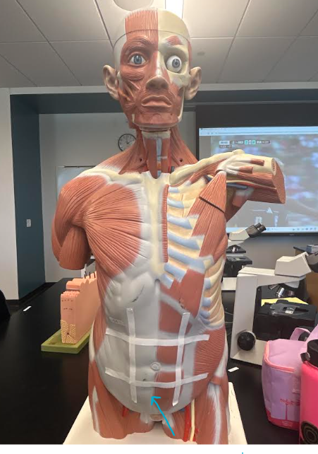 <p>ID abdominopelvic region</p>