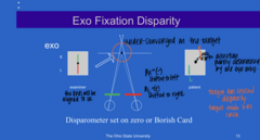 <p>How will a patient with an EXO deviation observe the disparometer?</p>