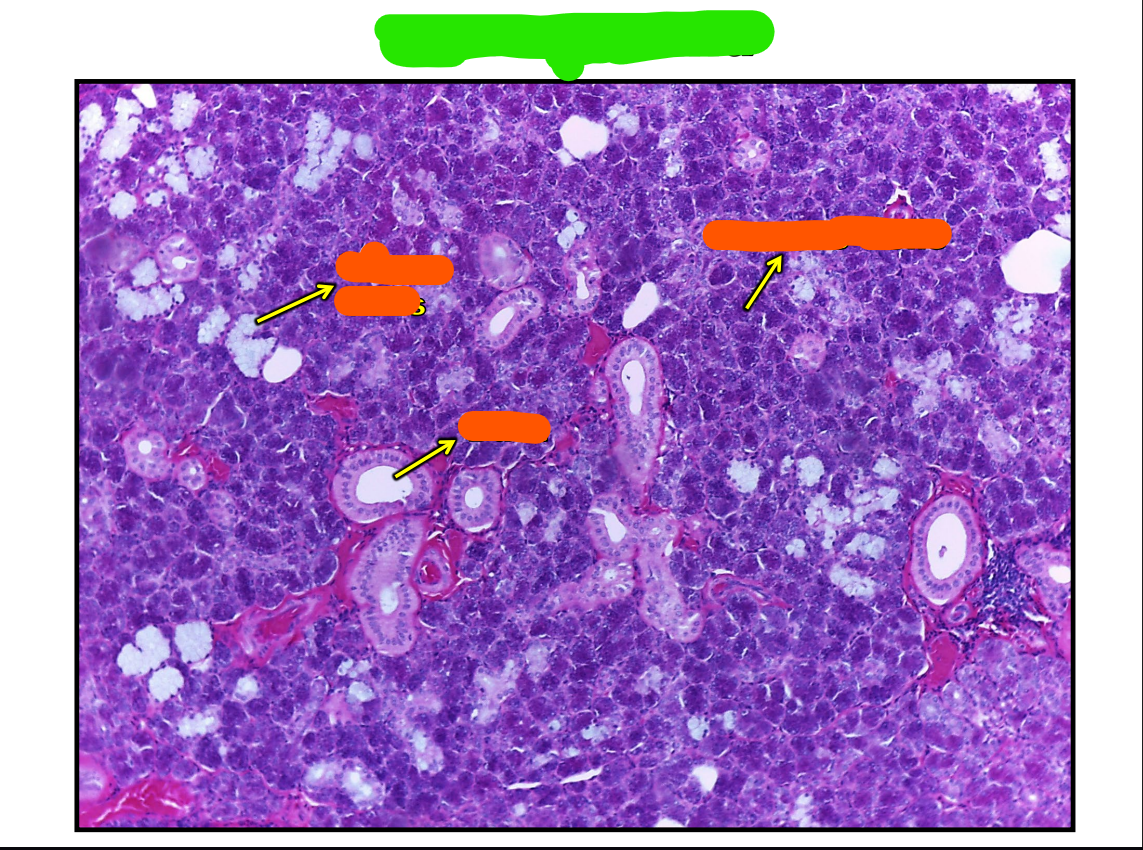 <p>What microscopic picture is this of?</p>