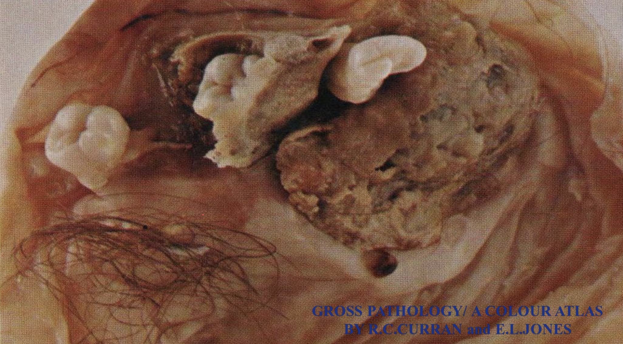 term image