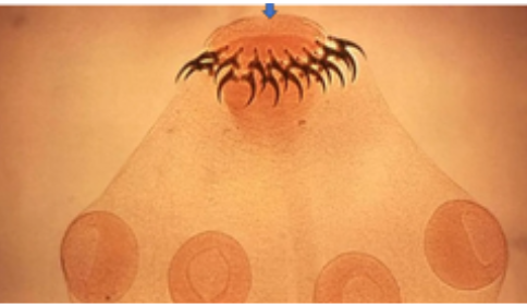 <p>1) What is the Anterior Groove?</p>