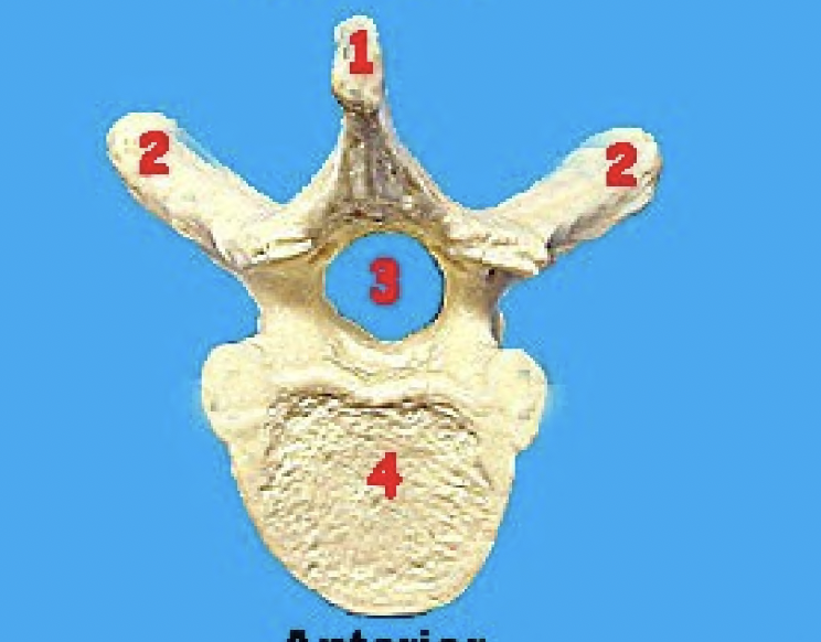 <p>what vertebra is this and what view</p>