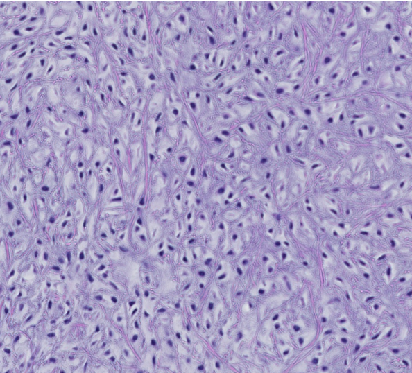 <p><span style="font-family: "Calibri Light";">The iris diaphragm is closed to enhance naturally glowing fibers, indicating thisis which type of cartilage in the larynx?</span></p>