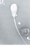 <p>What is this? Normal or abnormal sperm?</p>