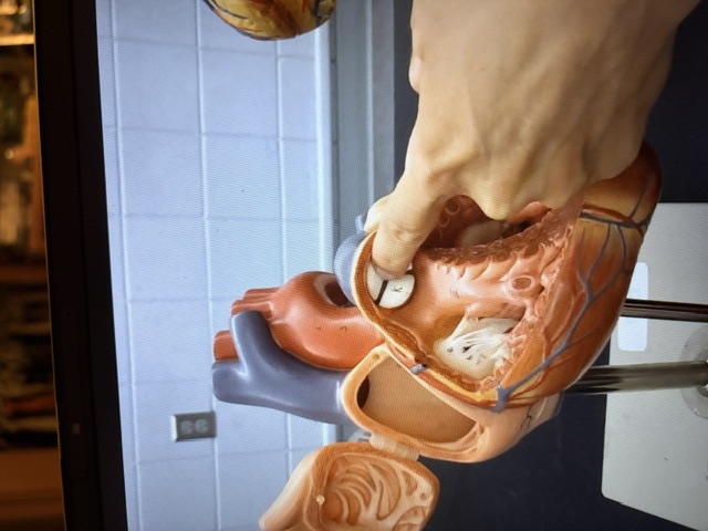 term image