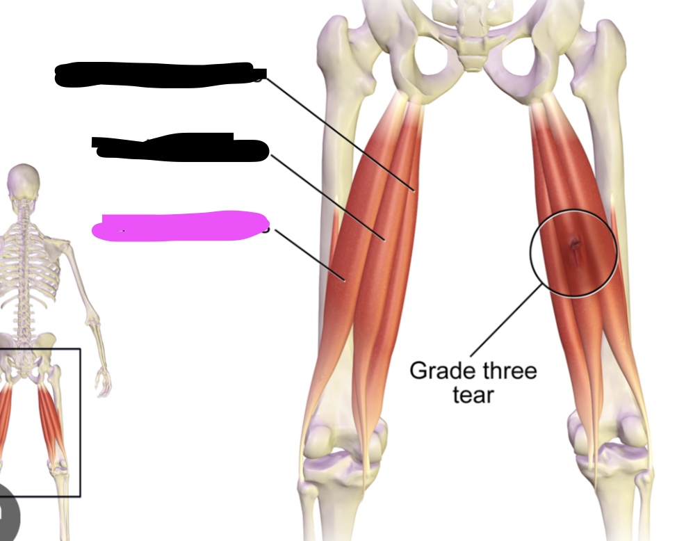<p>Flex knee - extends hip, flexes knee, laterally rotates leg</p>