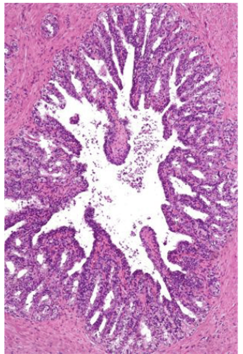 <p>• produces about 60% of total contribution to the semen</p><p>• secretes: fructose, prostaglandins, mucus</p>