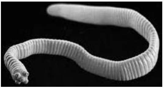 <p>which tapeworm is the <strong>smallest</strong> tapeworm to infect humans?</p><p></p>