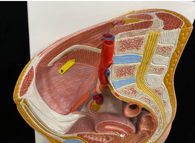<p>Name the muscle</p>