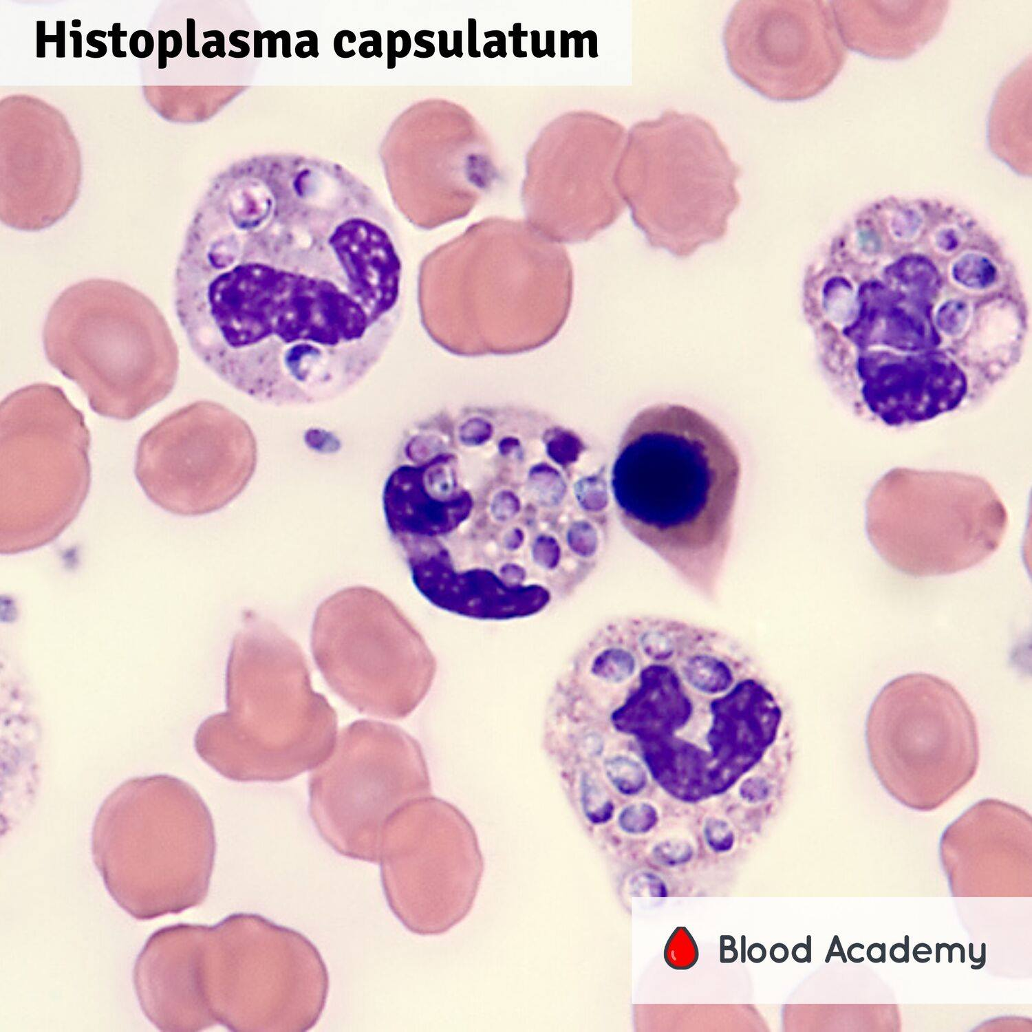 <p>the fungus is usually intracellular</p>