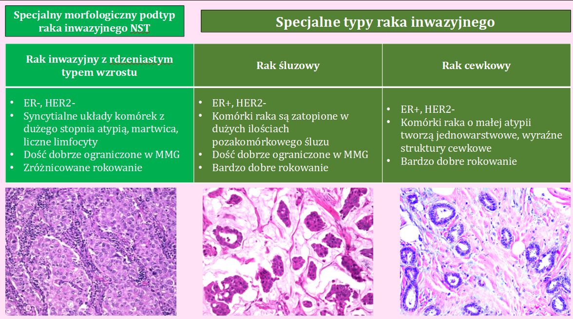 <p>E. wszystkie wyżej odpowiedzi są prawidłowe</p><p></p><p>Raki z licznymi naciekami limfocytowymi lepiej odpowiadają na neoadjuwantową chemioterapię</p>