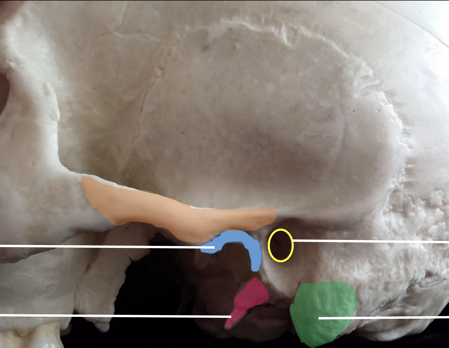 <p>What is the orange region highlighted on the temporal bone?</p>