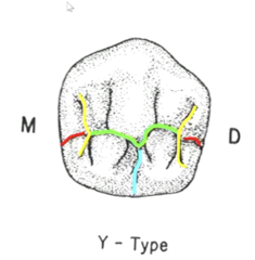 <p>- central</p><p>- triangular</p><p>- marginal</p><p>- lingual</p>