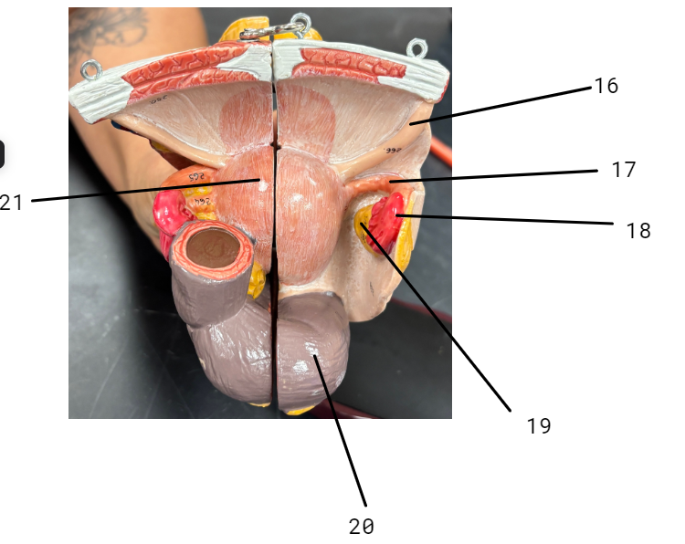 <p>Uterus</p>