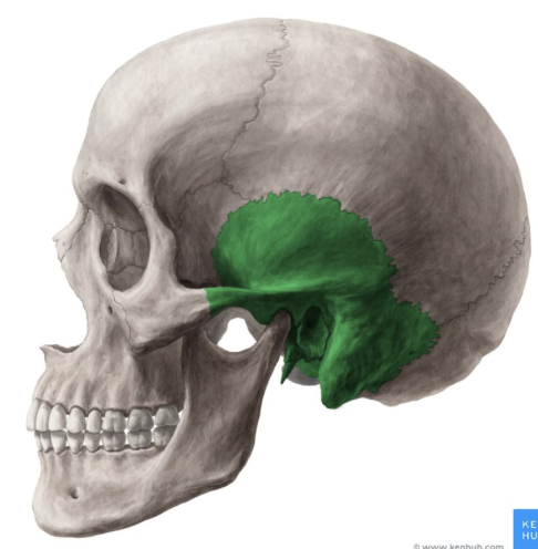 term image