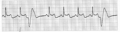 <p>Which rhythm is this?</p>
