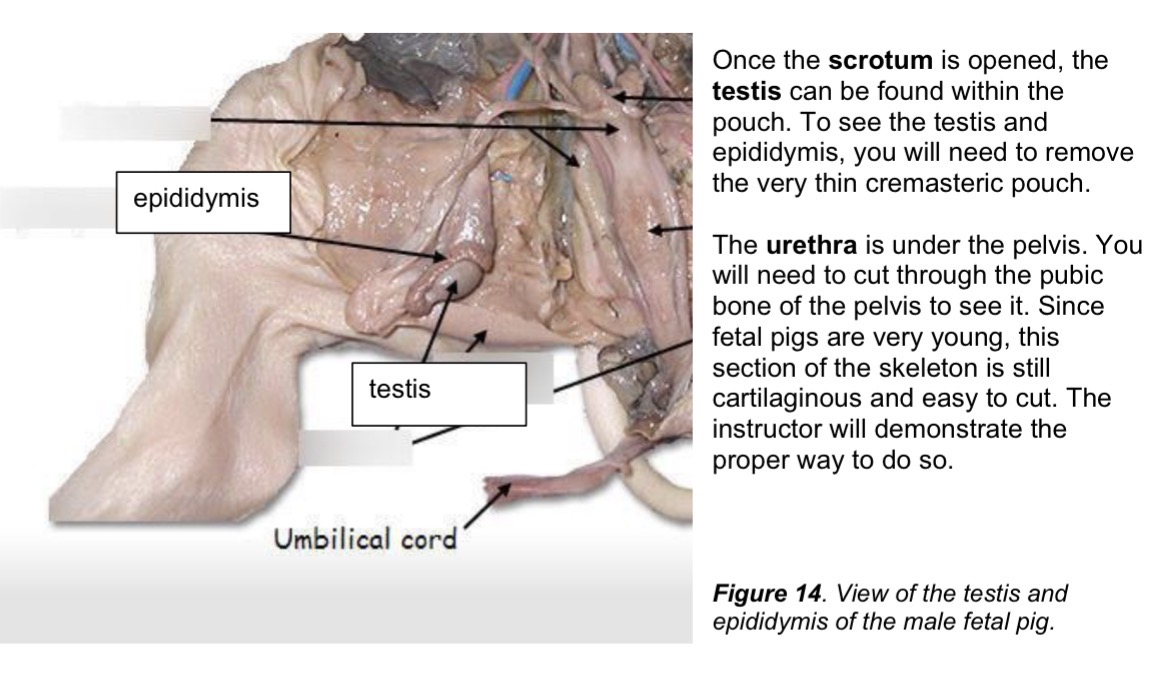 <p>Bulbourethral gland</p>
