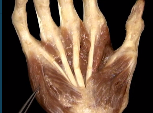 <p>Diep, Handpalm, 2 spieren die ongeveer zelfde plaats hebeen</p>