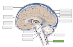 <p>This is the</p>