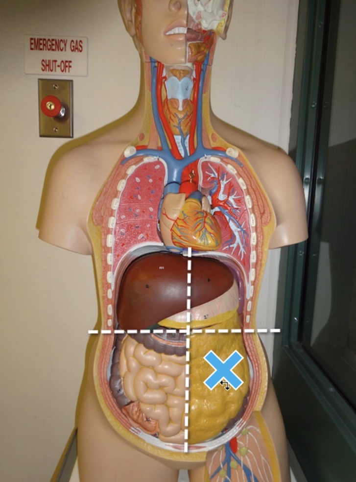 <p>Name the abdominopelvic quadrant the mark is in</p>