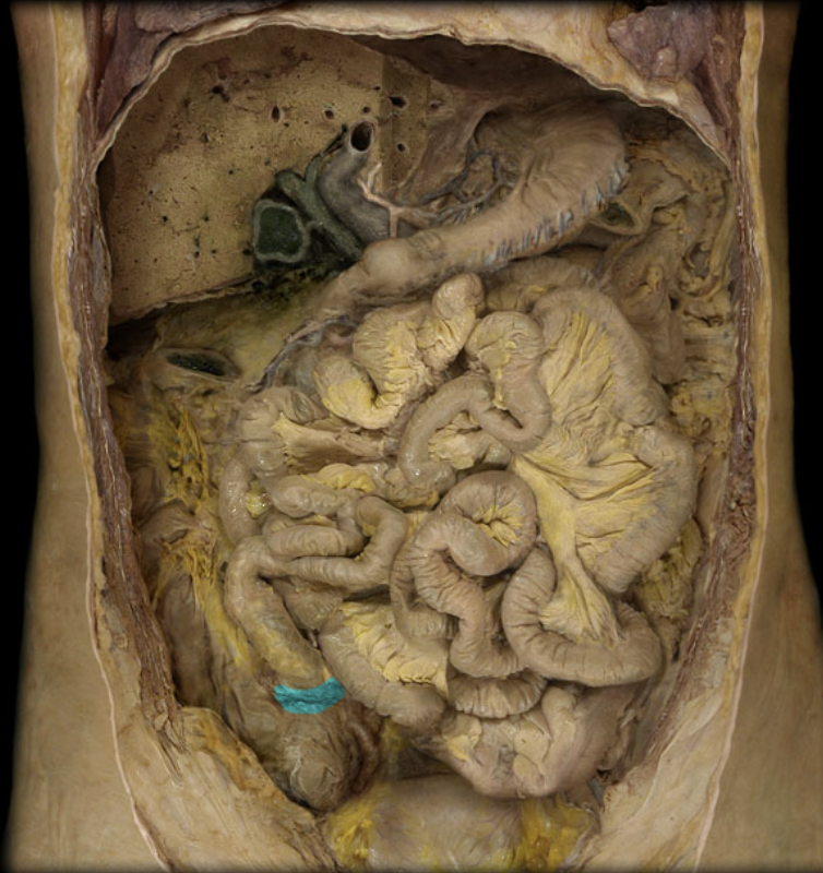 term image
