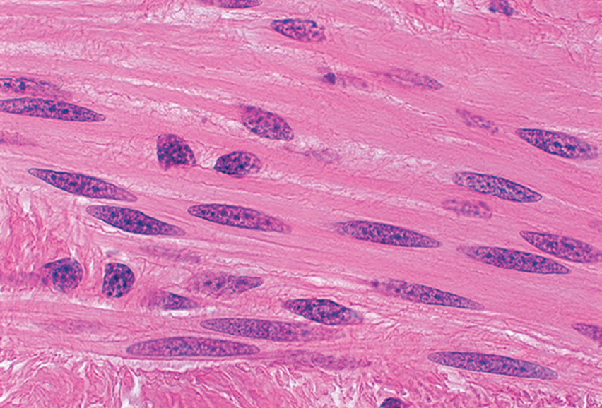 <p><span>Smooth Muscle</span></p>