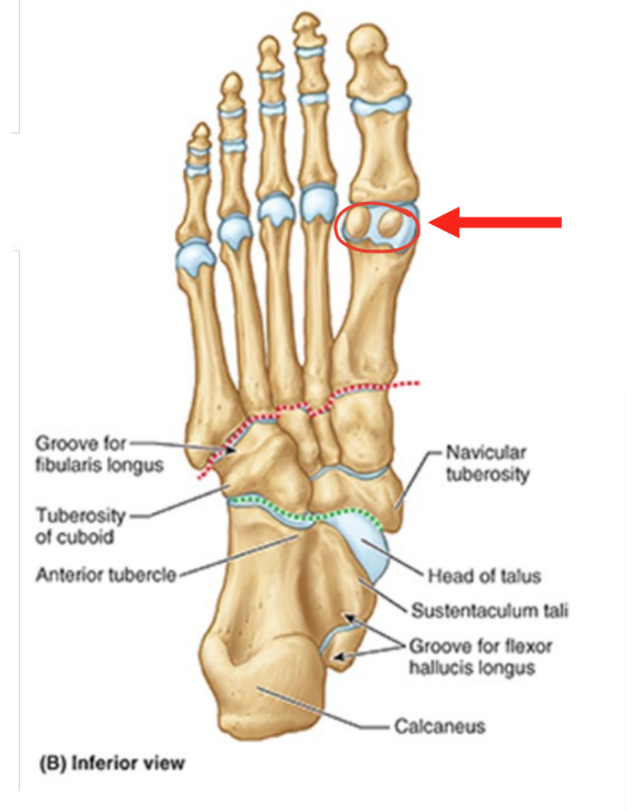 <ul><li><p>two pea-shaped bones located in the ball of the foot</p><ul><li><p>beneath the big toe joint</p></li></ul></li><li><p>acts as pulley for tendons</p><ul><li><p>help big toe move normally</p></li><li><p>provide leverage when big toe pushes off during walking & running</p></li></ul></li></ul><p></p>
