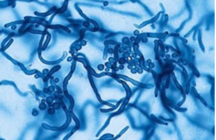 <p>basidiomycete, normal skin flora that infects oily areas of skin, lipophilic, dimorphic, cause of Pityriasis versicolor </p>