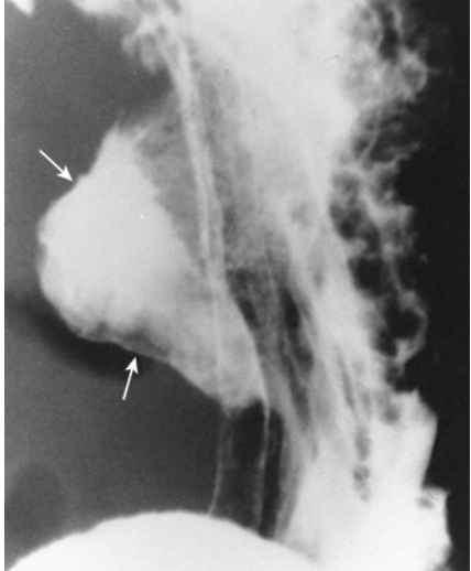 <p>What does this image show? </p>