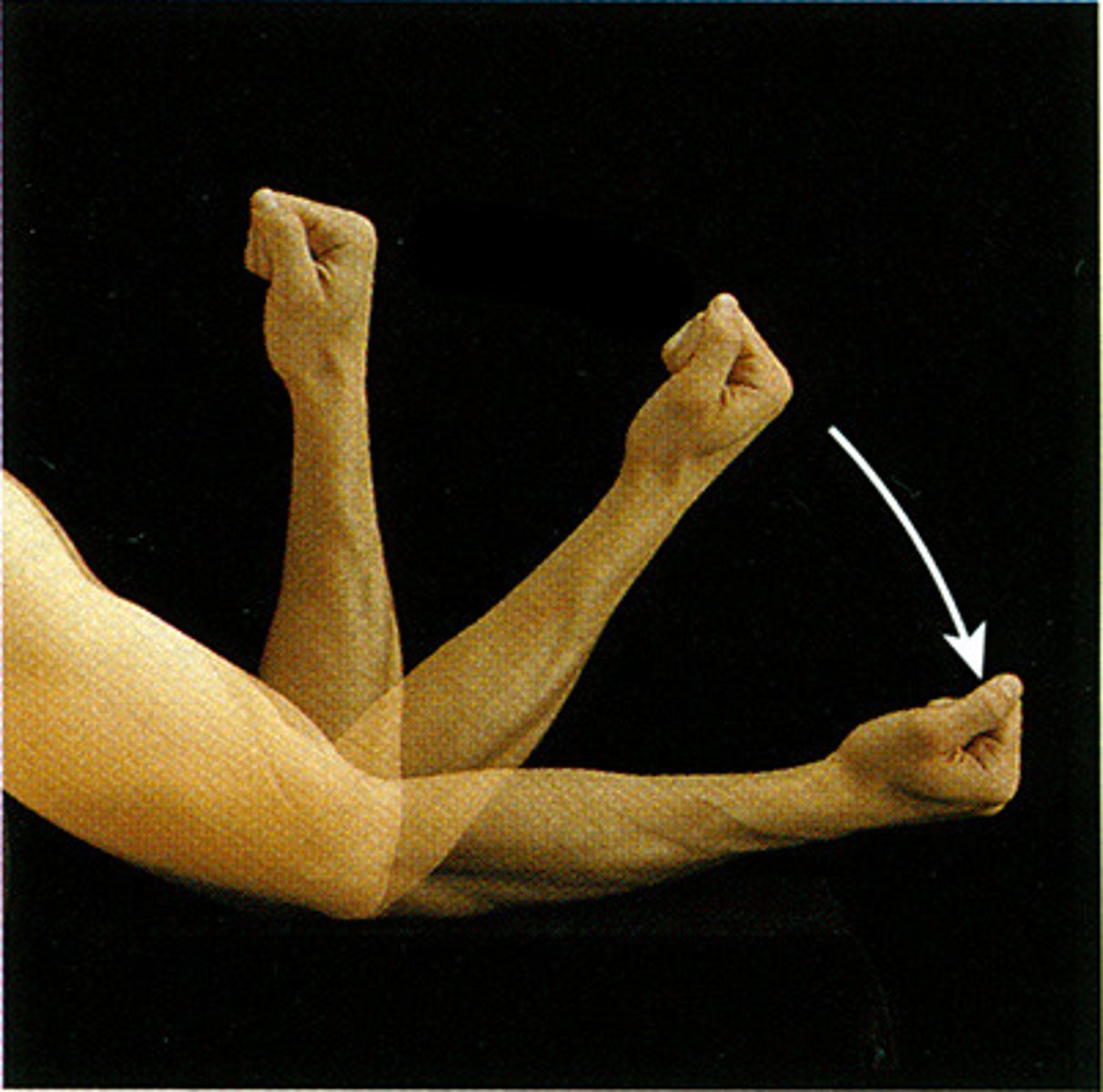 <p>Straightening of a joint</p>