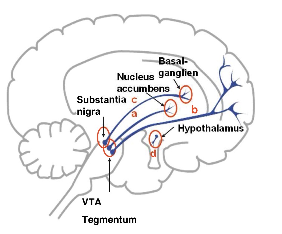 <p>a) Mesolimbisches System →zu viel Dopamin - Positivsymptome</p><p>b) Mesocorticales System → zu wenig Dopamin -Negativsymptome</p><p>c) Nigrostriatales System → reguliert Motorik</p><p>d) Tuberoinfundibuläres System → reguliert Prolaktin</p>