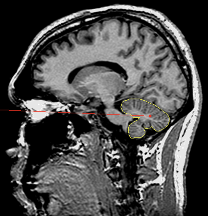 <p>What is the area highlighted called?</p>