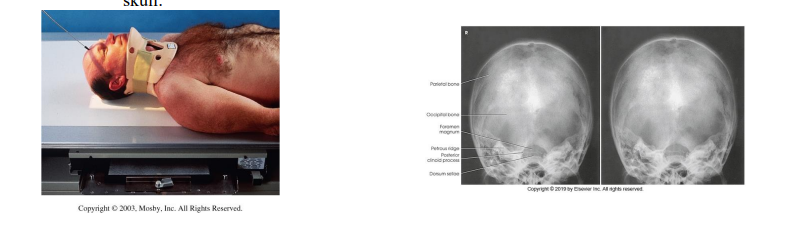 <p>what skull special view is this?</p>